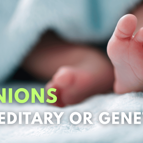Are Bunions Hereditary or Genetic?