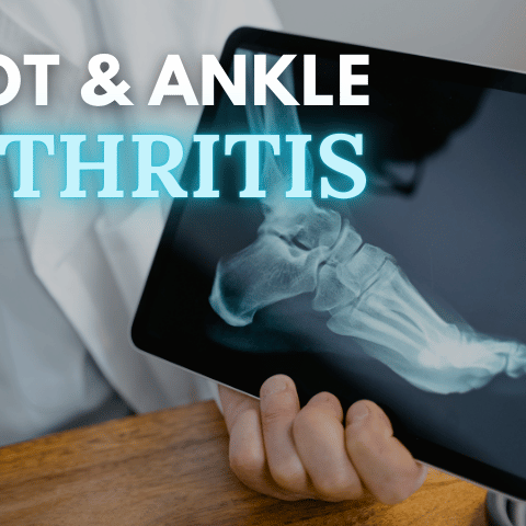 What Causes Arthritis in the Foot and Ankle