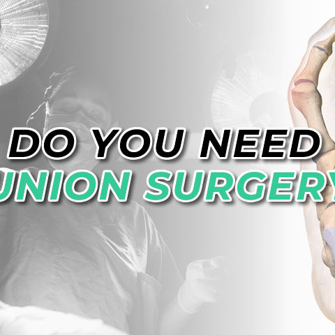 Should You Undergo Surgery For a Bunion?
