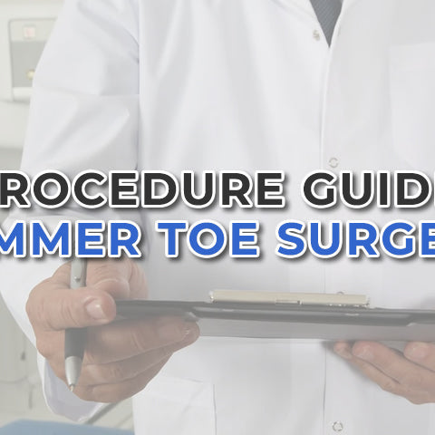 Hammer Toe Surgery