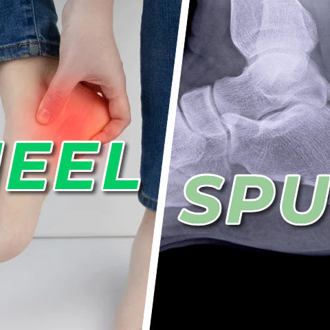 What is a Heel Spur?
