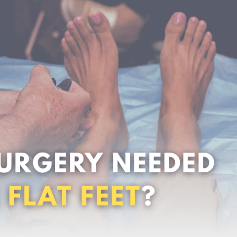 Is Surgery Needed For Flat Feet?