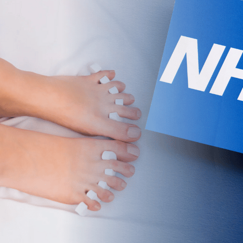 Does the NHS Recommend Toe Separators?
