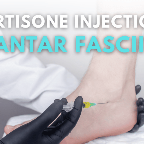 Do Cortisone Injections Help Plantar Fasciitis?