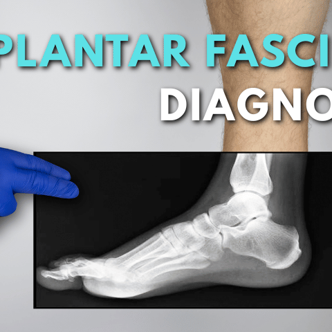 How is Plantar Fasciitis Diagnosed?