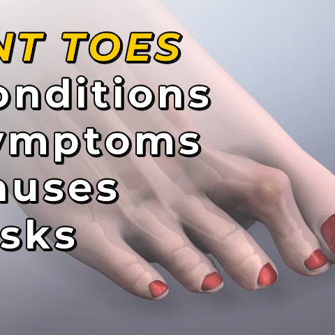 Bent Toes - Hammer, Claw or Mallet Toes