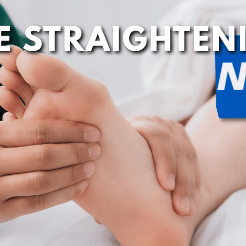 Can You Get Toes Straightened on the NHS?