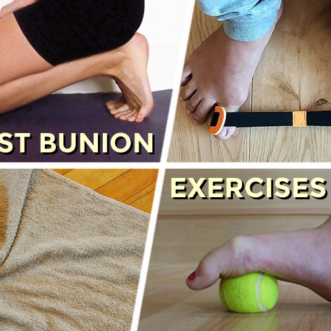5 Best Bunion Exercises