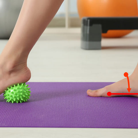 What is Flat Feet or Fallen Arches?