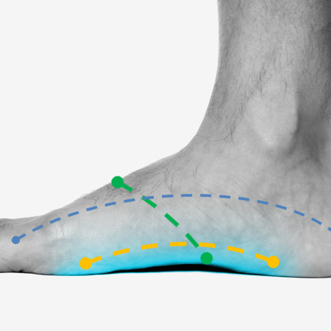 7 Most Likely Causes of Pain in the Foot Arch