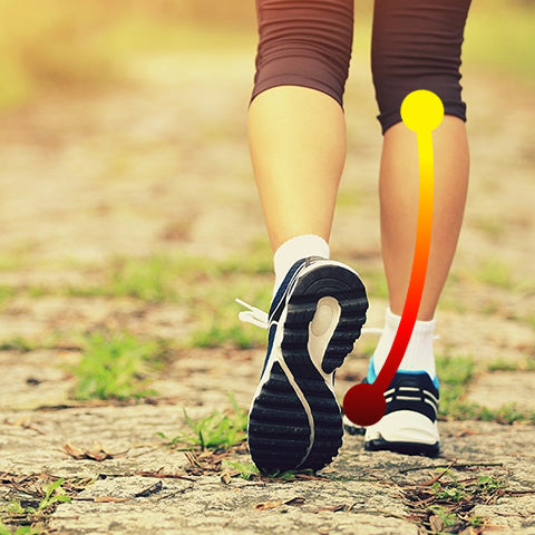 What is Overpronation?