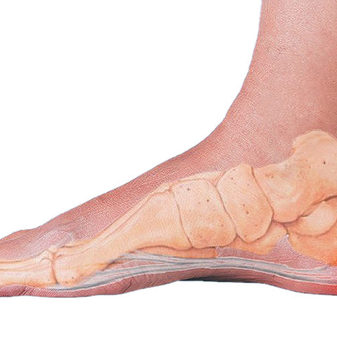 How to Heal Plantar Fasciitis Quickly