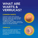 Dr Scholl’s Freeze Away Max Verruca & Wart Remover