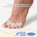 DuraFlex Gel Toe Separators