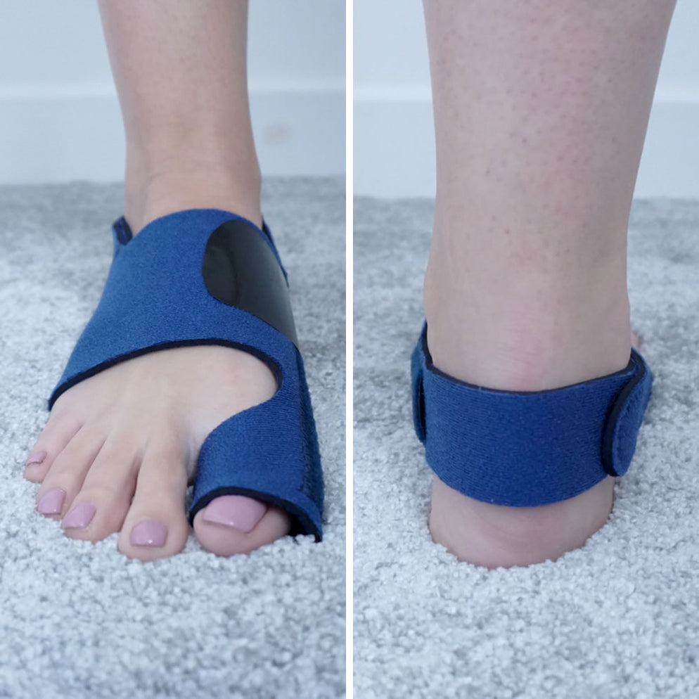 ActiveRestore Bunion Corrector Splints 3 Adjustable Velcro Straps